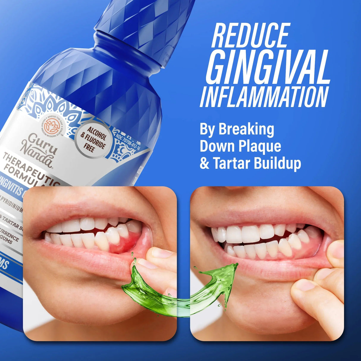 Healthy Gums Oral Rinse, Wild Mint