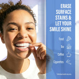 Whitening Strips – 30 Day Treatment