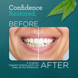 Hydroxyapatite & Neem Whitening Toothpaste, Fluoride Free – 4.2 oz