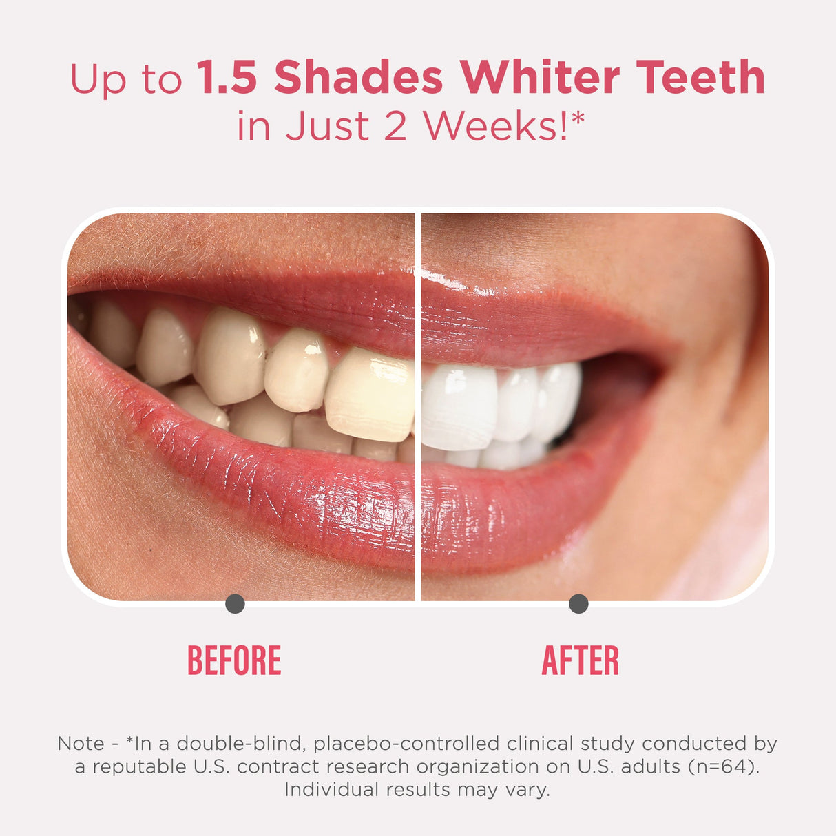 Sensitive Whitening Strips – 16 Day Treatment