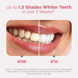 Sensitive Whitening Strips – 16 Day Treatment