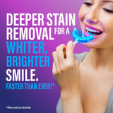 Wired LED Teeth Whitening Kit