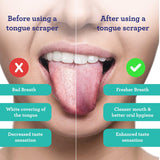 U Shaped Stainless Steel Tongue Scraper – 2 Pack